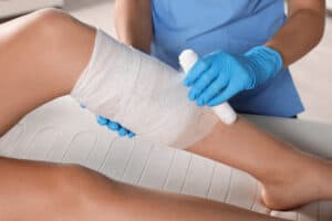 Picture of a doctor wrapping gauze around a wound on a woman's leg.